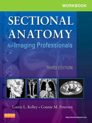 cover image of Workbook for Sectional Anatomy for Imaging Professionals--E-Book